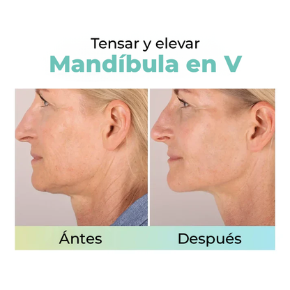 StopWrinkle® - Parches Rellenadores para Arrugas e Imperfecciones