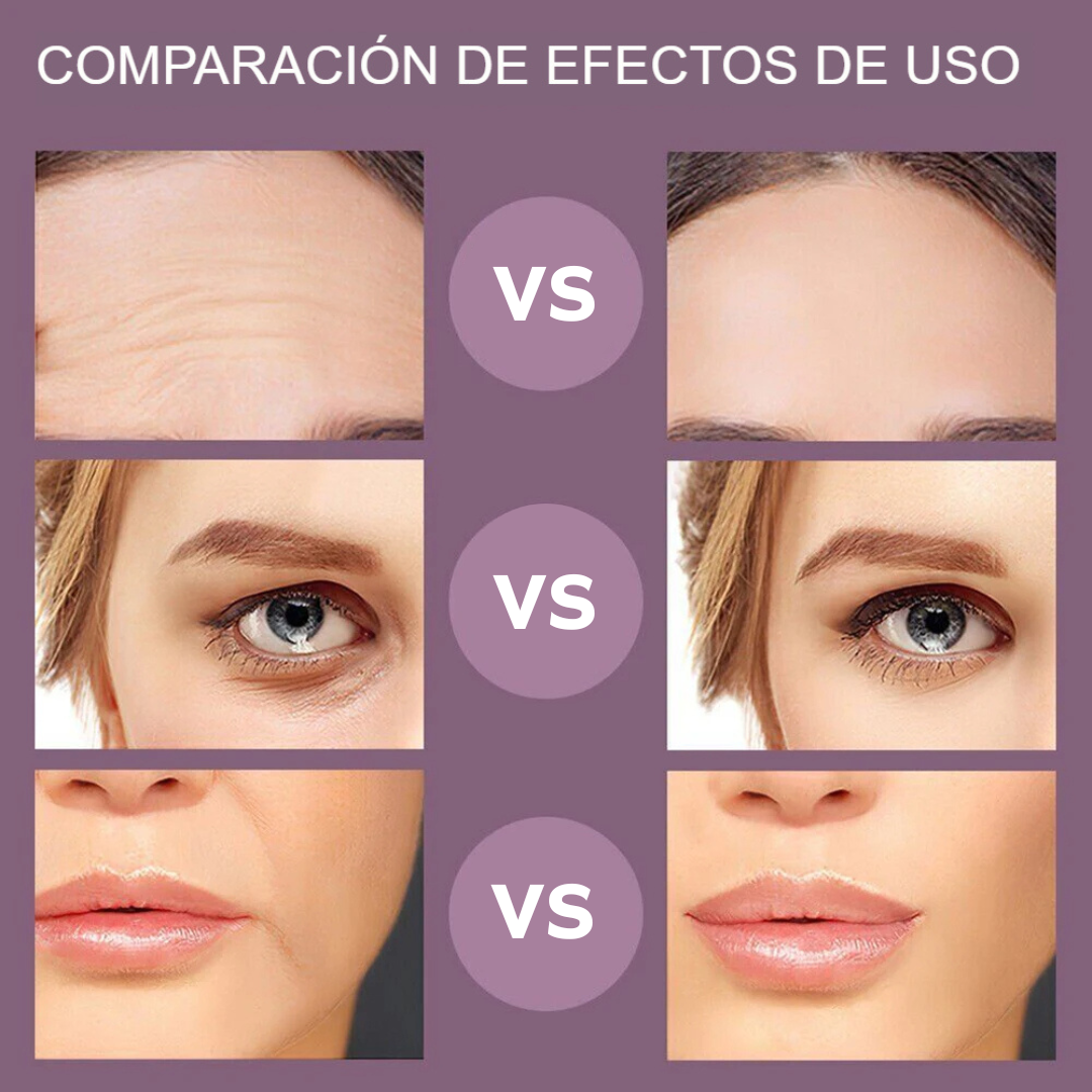 SkinGlow® - Dispositivo de Rejuvenecimiento Facial con Microcorriente y Estimulación Muscular