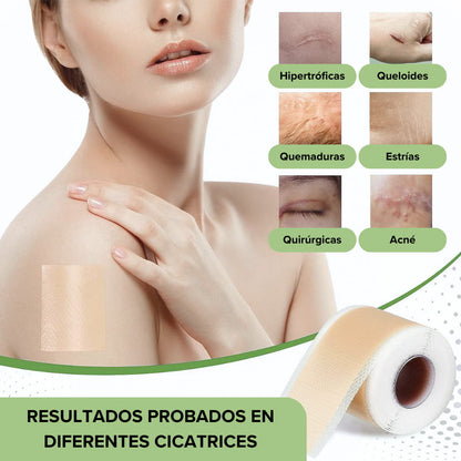 ScartSheets® - Cinta de Silicona Cicatrizante