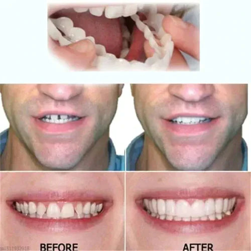 Diente ProMax® - Sonrisa Brillante y Atractiva en Segundos