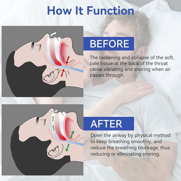 NoseClip® Clip Antironquidos - Reduce los ronquidos en un 95%