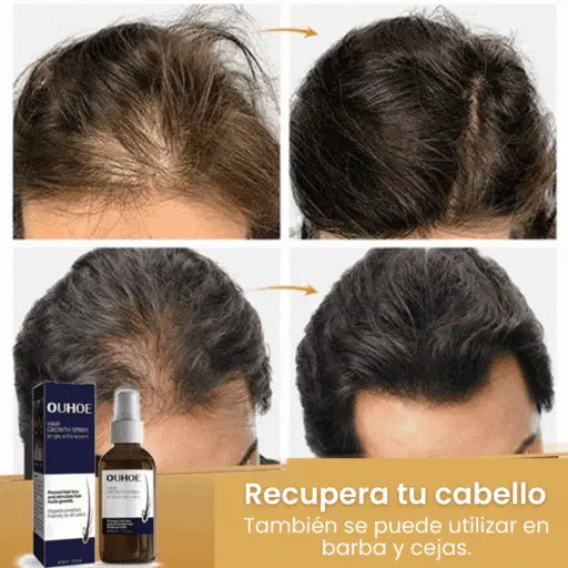 GrowBread® Spray capilar - Estimula el Crecimiento del cabello en 14 días