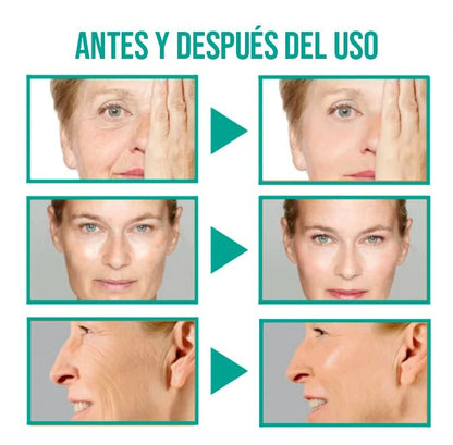 SexyFace® Serum anti edad - Piel Joven en Solo 2 Semanas