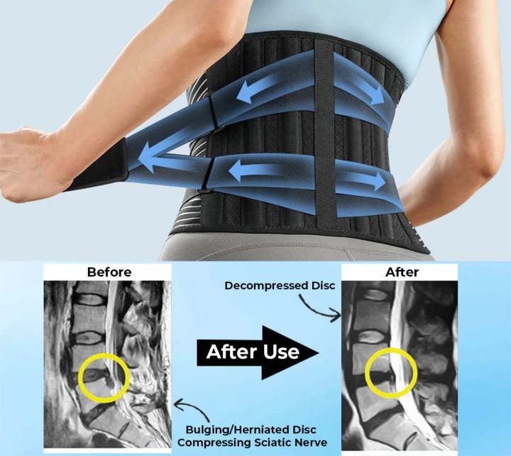 OrthoBelt® Cinturón Lumbar - Alivia el Dolor de Espalda y Mejora tu Postura