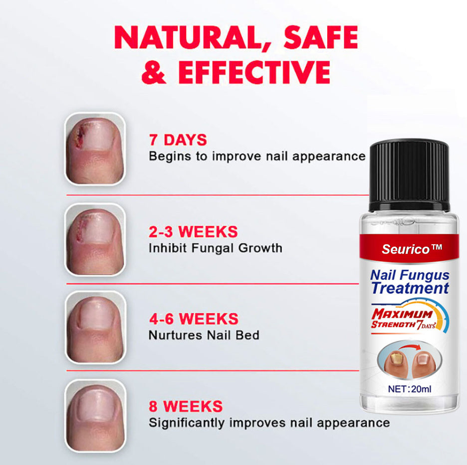 NailFungus® Aceite Rejuvenecedor de Uñas - Elimina Hongos y Fortalece en Semanas