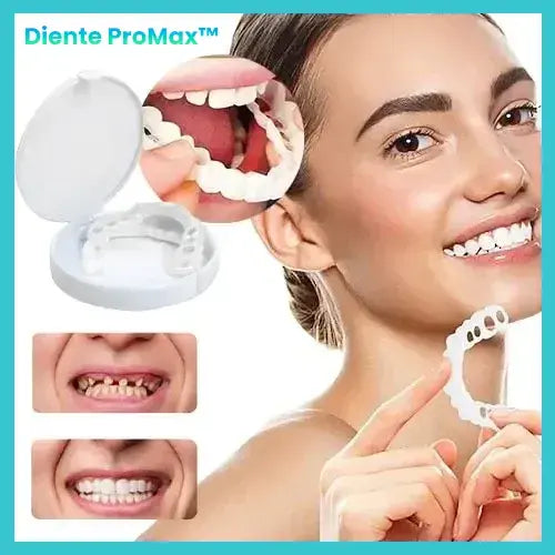 Diente ProMax® - Sonrisa Brillante y Atractiva en Segundos