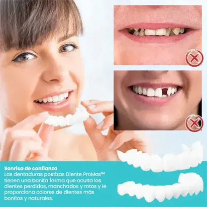 Diente ProMax® - Sonrisa Brillante y Atractiva en Segundos