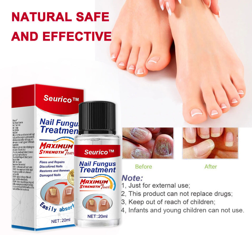 NailFungus® Aceite Rejuvenecedor de Uñas - Elimina Hongos y Fortalece en Semanas