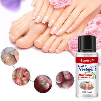 NailFungus® Aceite Rejuvenecedor de Uñas - Elimina Hongos y Fortalece en Semanas